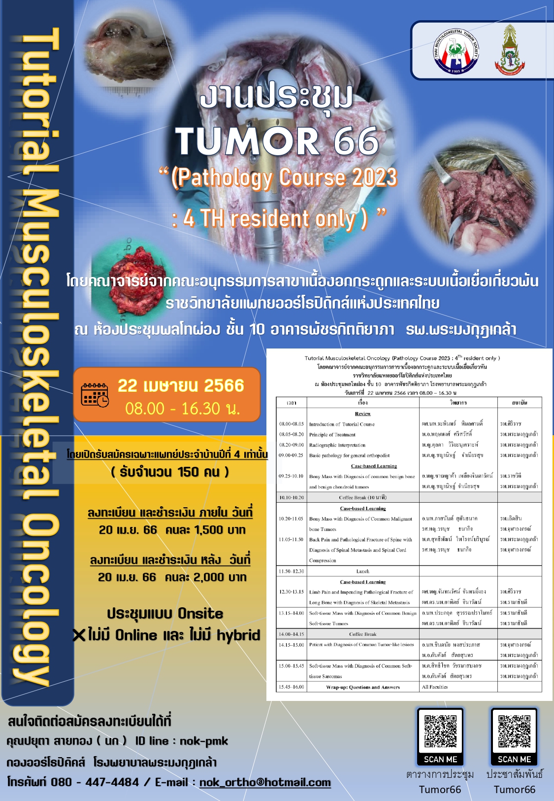 TUMOR 2023